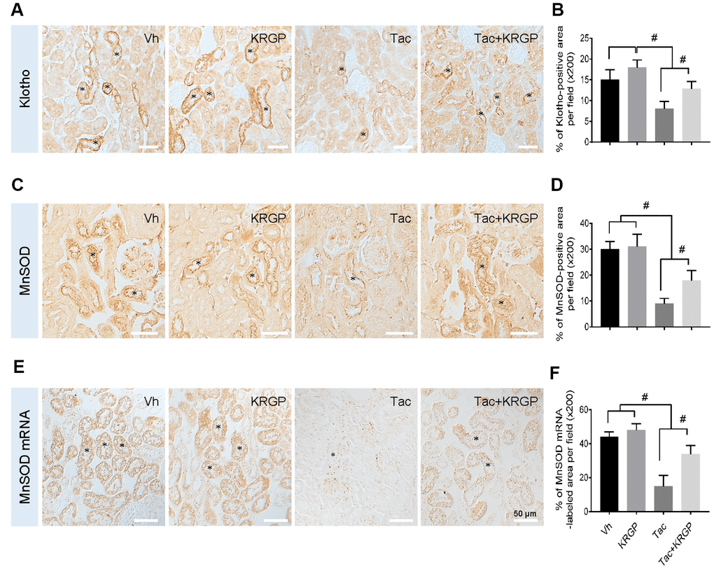 Ginseng increases Klotho expression by FoxO3mediated manganese