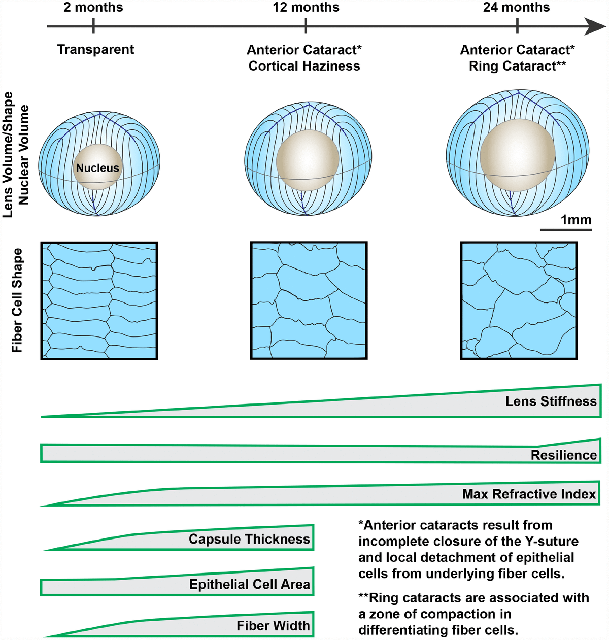 Agerelated changes in eye lens biomechanics, morphology, refractive