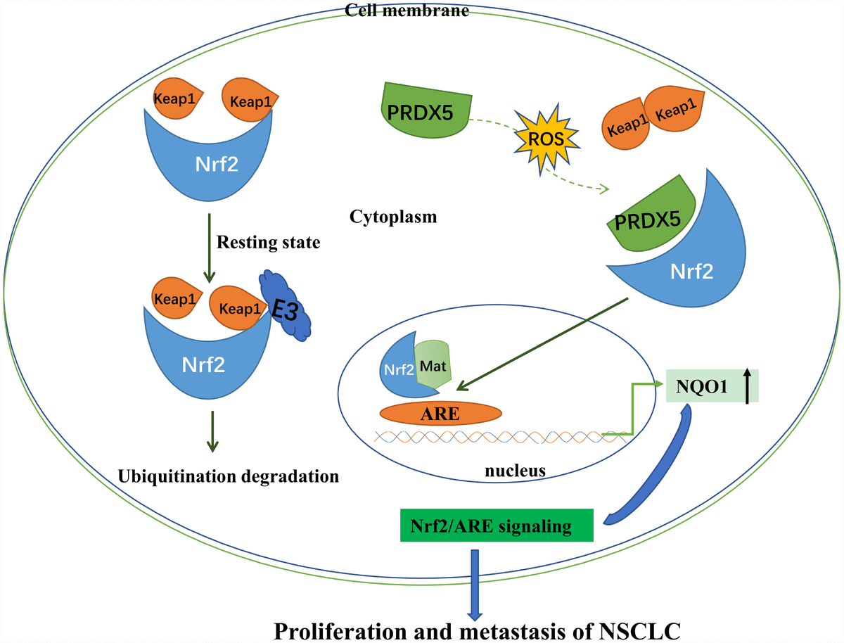 PRDX5 as a novel binding partner in Nrf2mediated NSCLC progression
