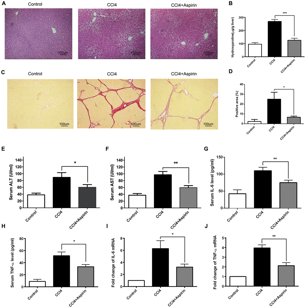 Aspirin alleviates hepatic fibrosis by suppressing hepatic stellate