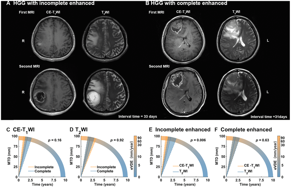 Association of tumor growth rates with molecular biomarker status a