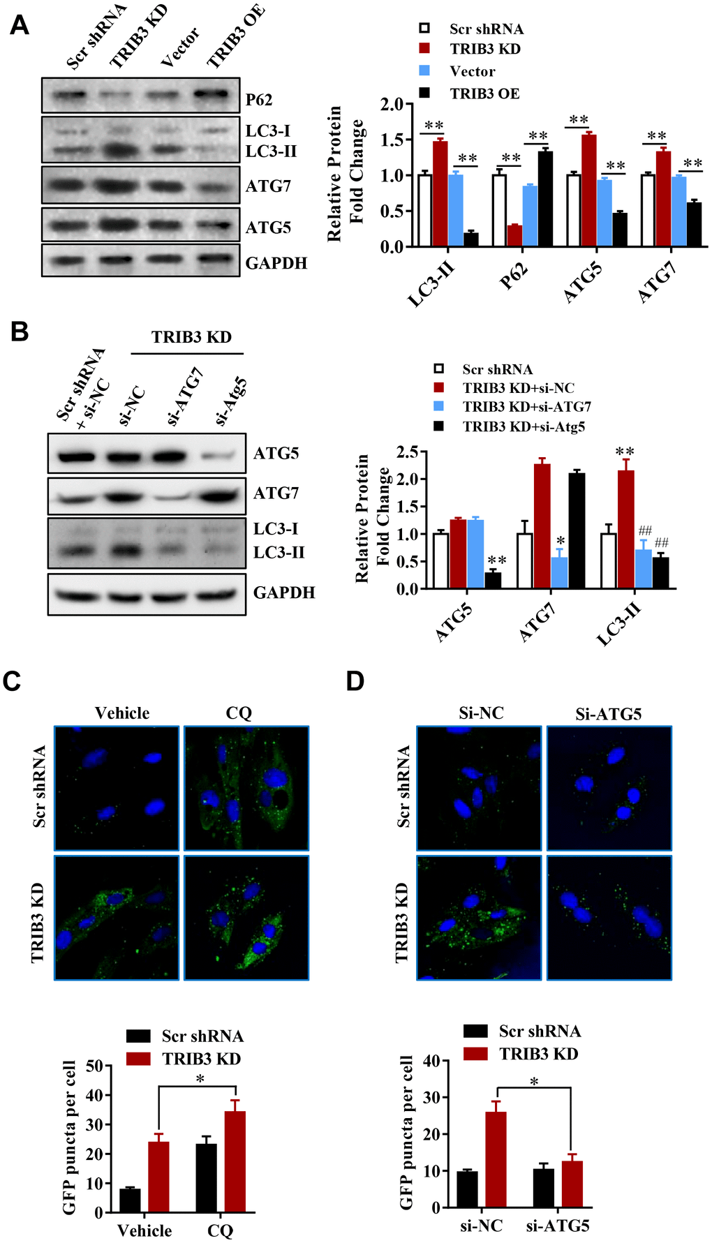 TRIB3 facilitates glioblastoma progression via restraining autophagy