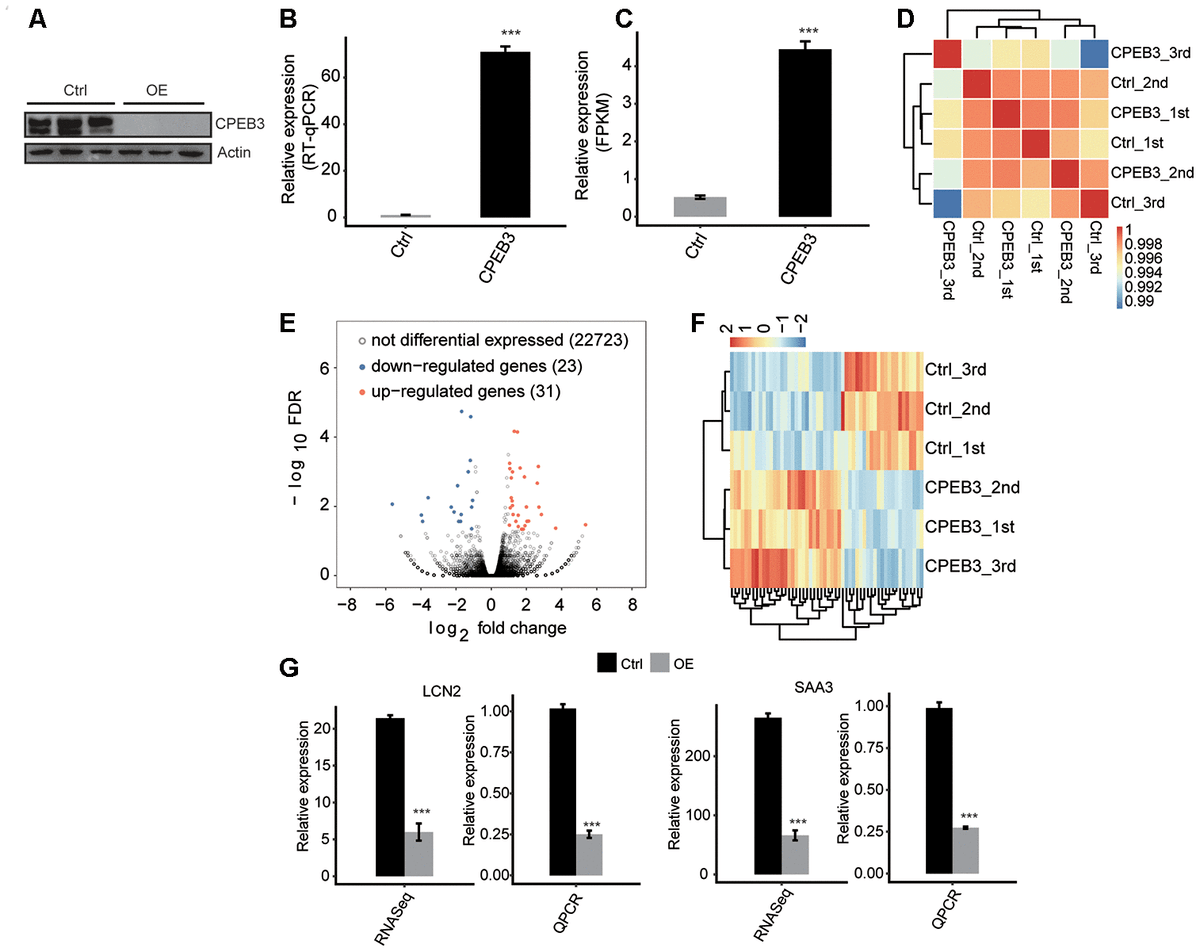 Aging CPEB3 regulates neuronspecific alternative splicing and