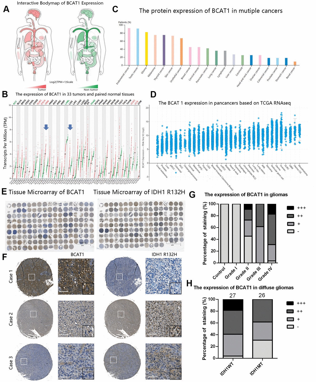 Enrichment of branched chain amino acid transaminase 1 correlates with