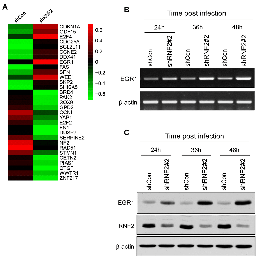 Ring finger protein 2 promotes colorectal cancer progression by