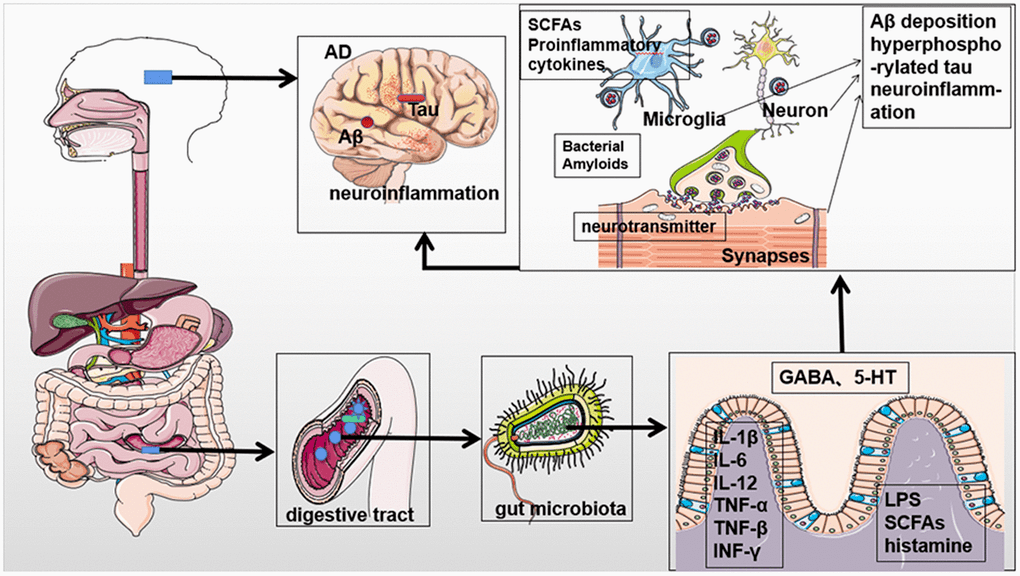 Gut microbial involvement in Alzheimer's disease pathogenesis Aging