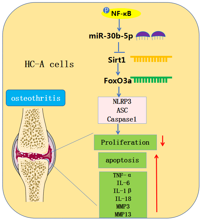 NFκB inducible miR30b5p aggravates joint pain and loss of articular