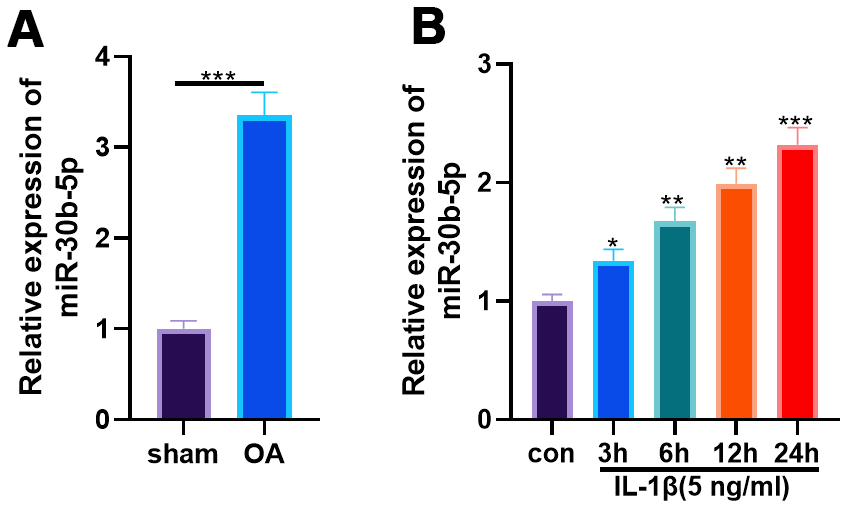 NFκB inducible miR30b5p aggravates joint pain and loss of articular