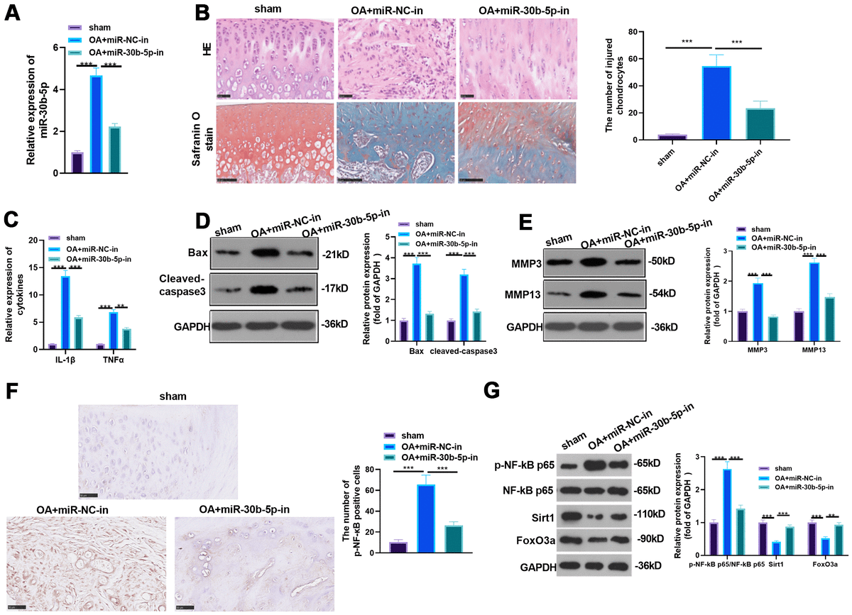 NFκB inducible miR30b5p aggravates joint pain and loss of articular