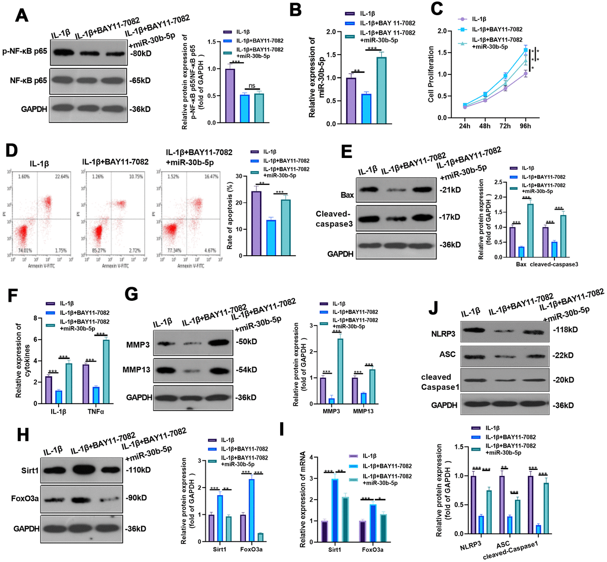 NFκB inducible miR30b5p aggravates joint pain and loss of articular