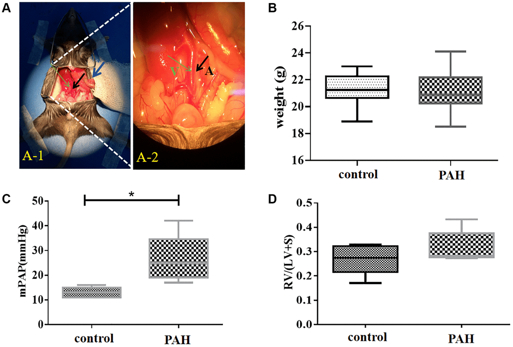 BMPR2 promoter methylation and its expression in valvular heart disease