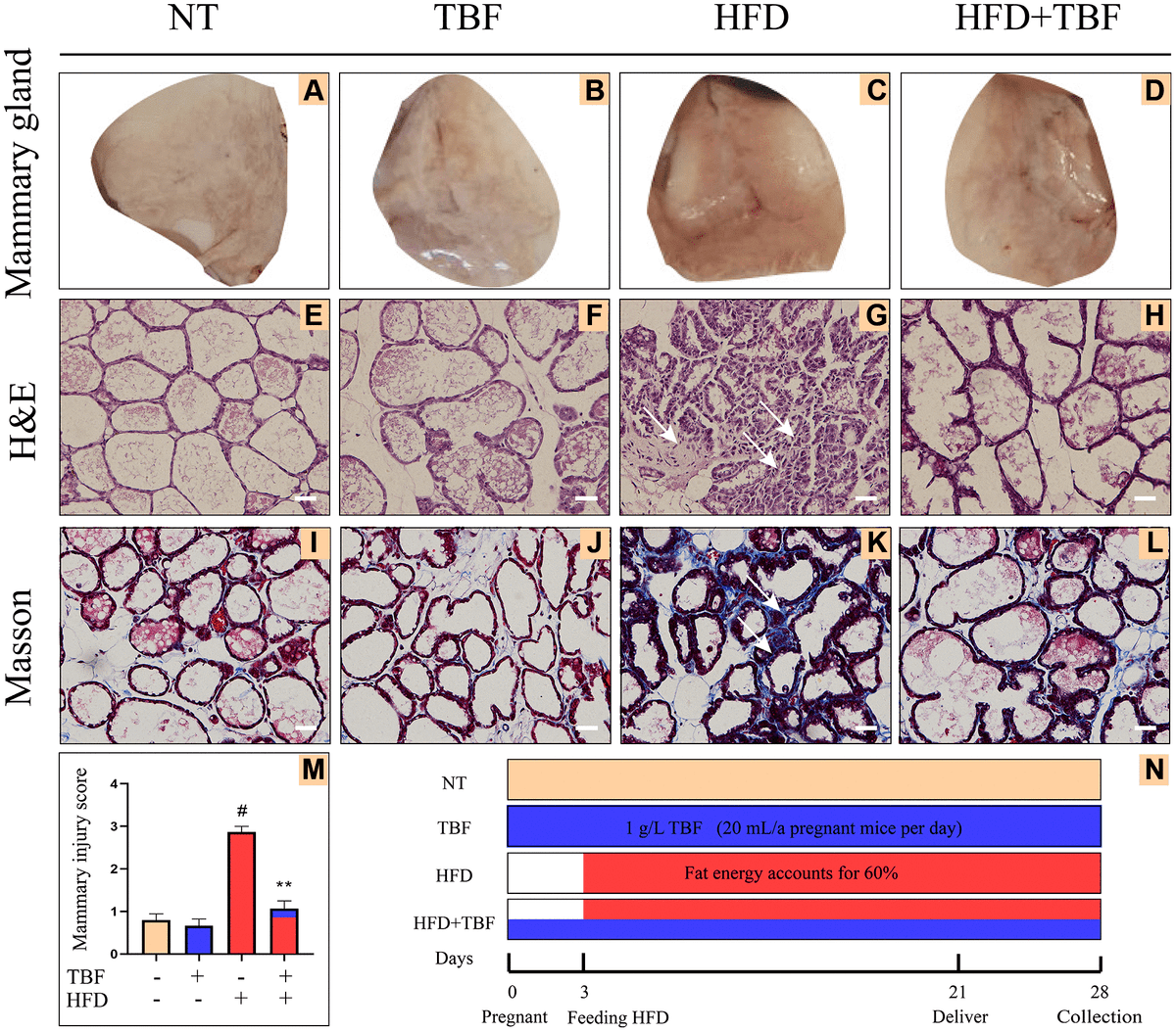 Tartary buckwheat flavonoids relieve the tendency of mammary fibrosis
