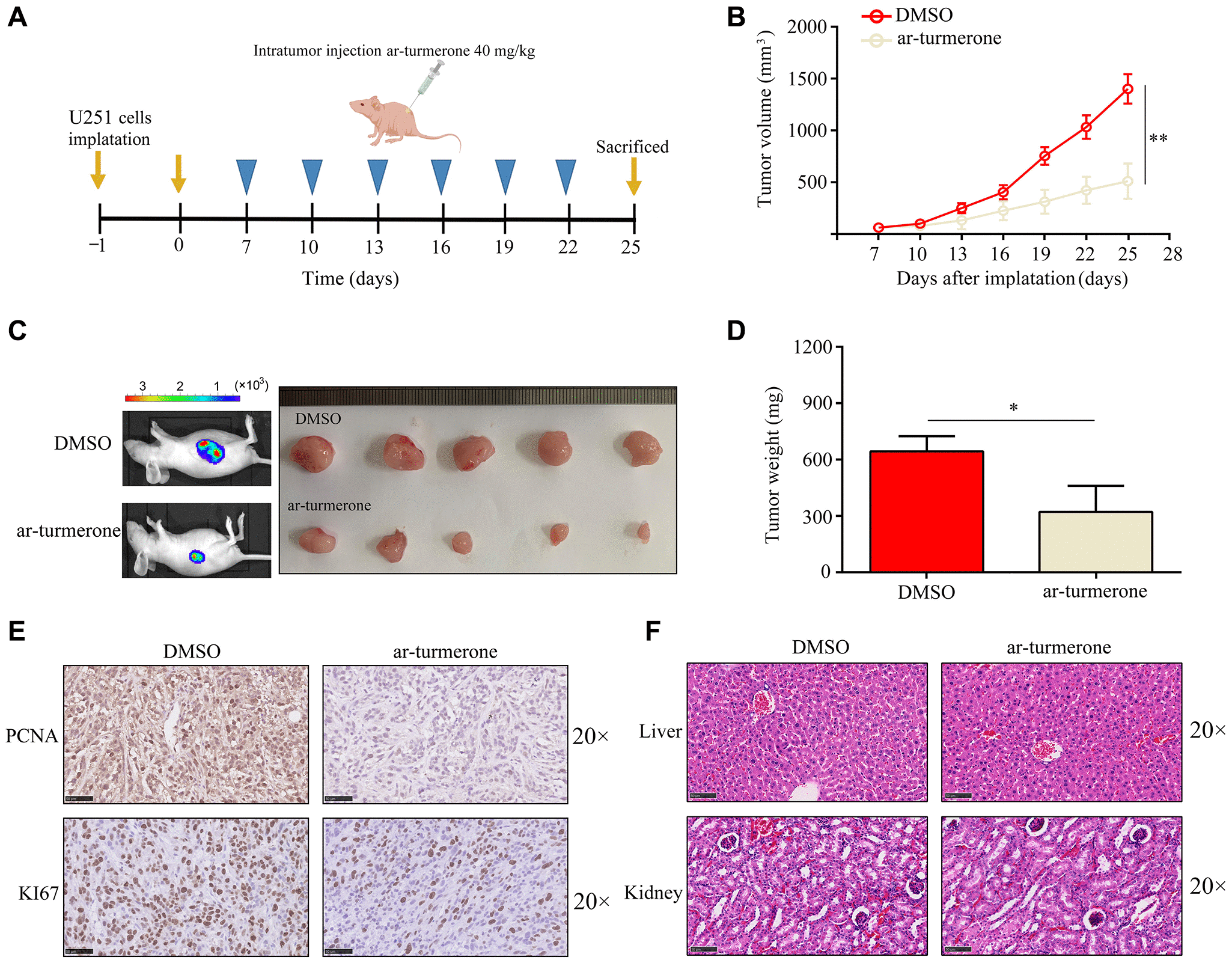 Arturmerone inhibits the proliferation and mobility of glioma by
