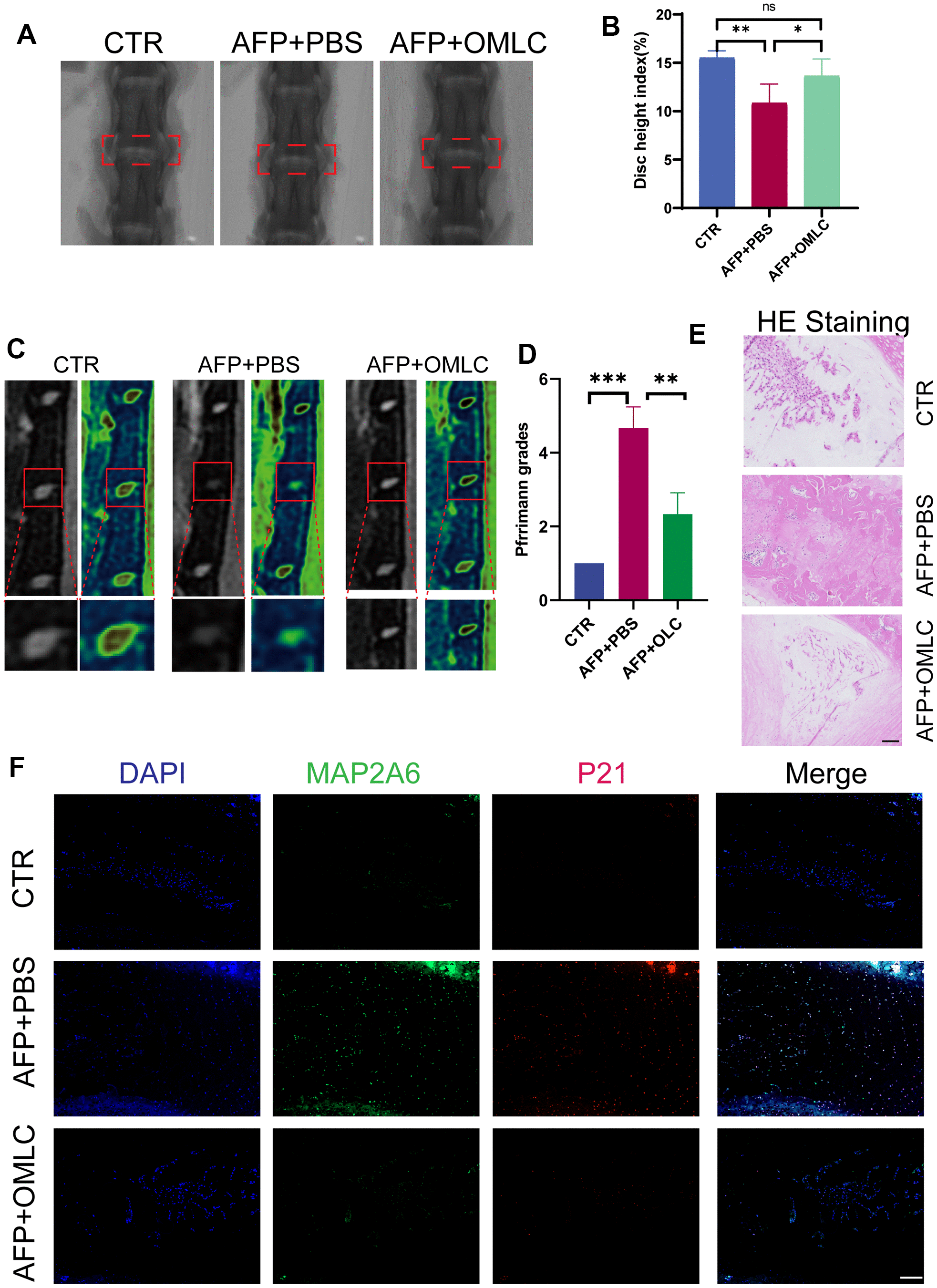 Omilancor mitigates the senescence of nucleus pulposus cells induced by
