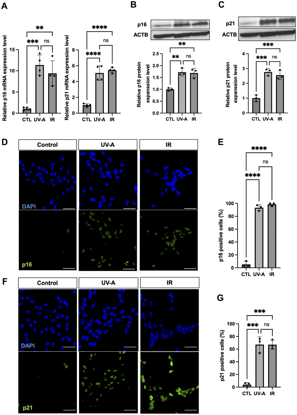 Senescent characteristics of human corneal endothelial cells upon