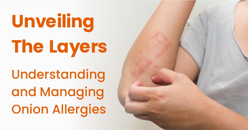 Unveiling the Layers Understanding and Managing Onion Allergies