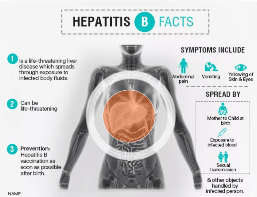 Hepatitis B Symptoms, Diagnosis and Treatment AILBS India