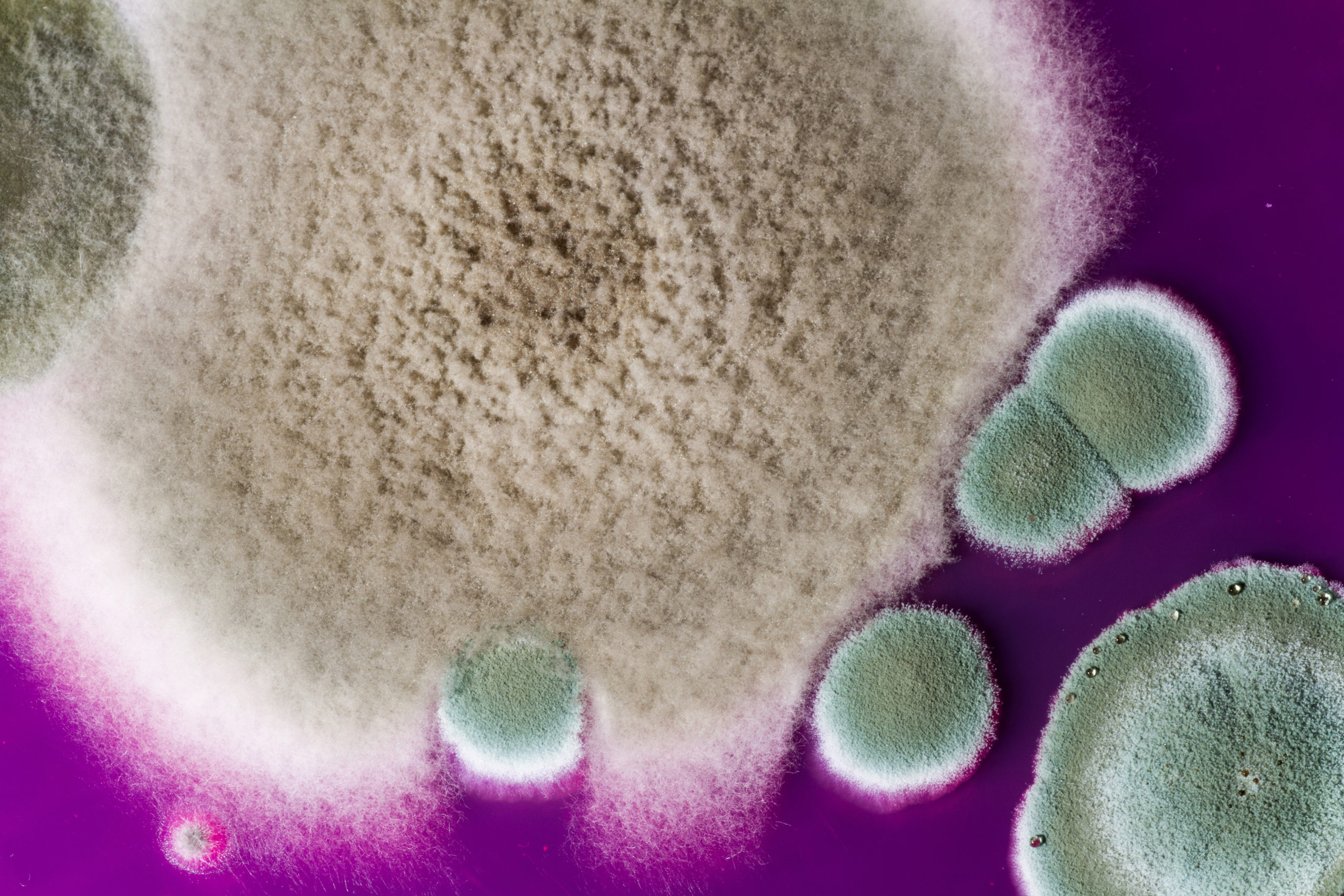 Microbial Compressed Air Sampling Explained Trace Analytics, the