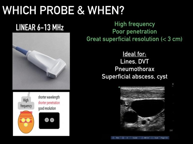 Image optimization Alberta Sono