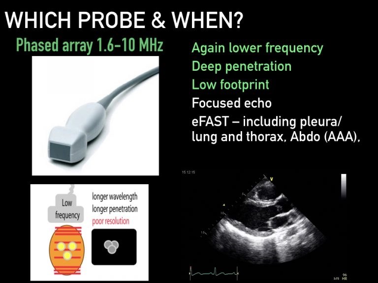 Image optimization Alberta Sono