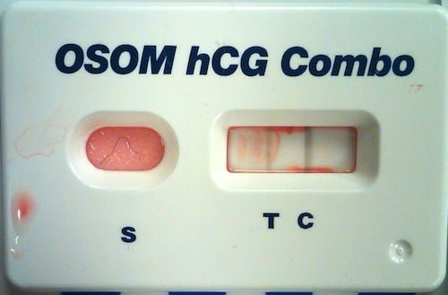 Trick of the Trade Urine pregnancy test without urine