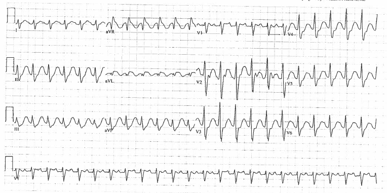 Acmt Toxicology Visual Pearls Abnormal Ecg