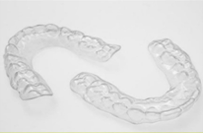Retainers in Orlando, FL Removable Retainers Near You