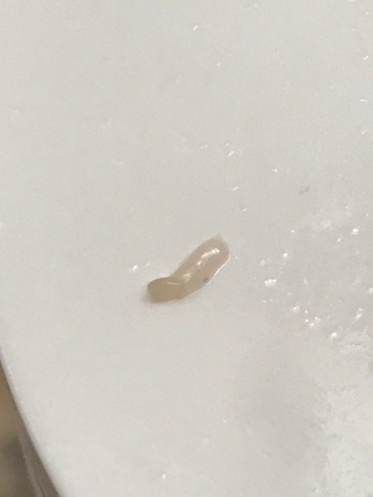 white worms in house Archives All About Worms