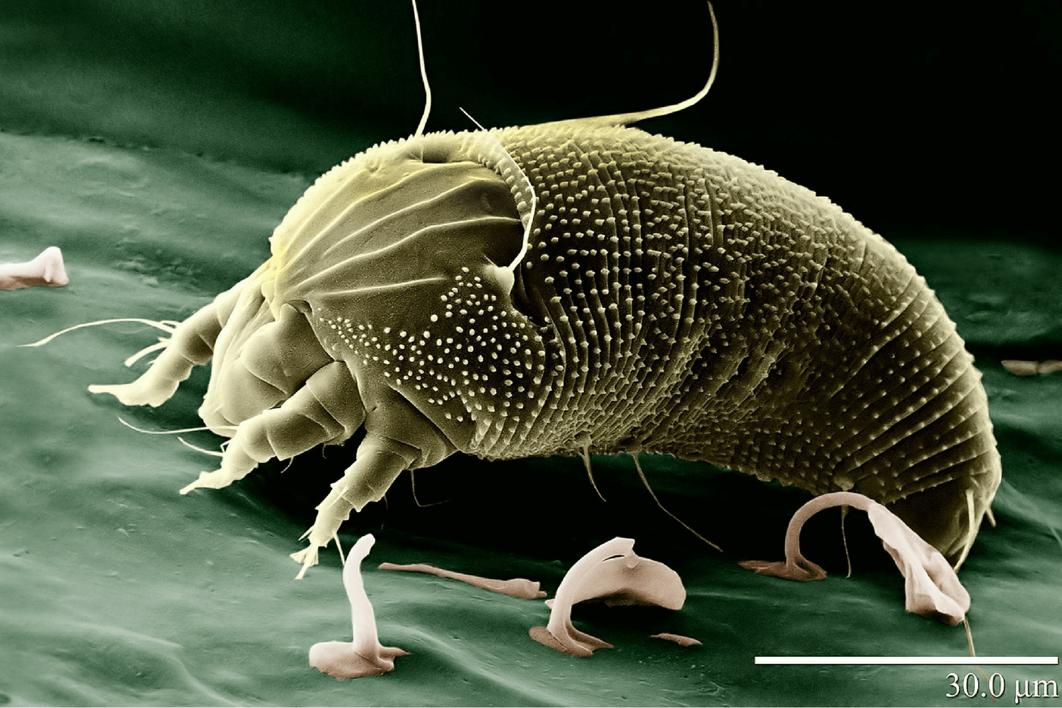 House Dust Mites and Monsoon Season in Phoenix Ahwatukee Allergist