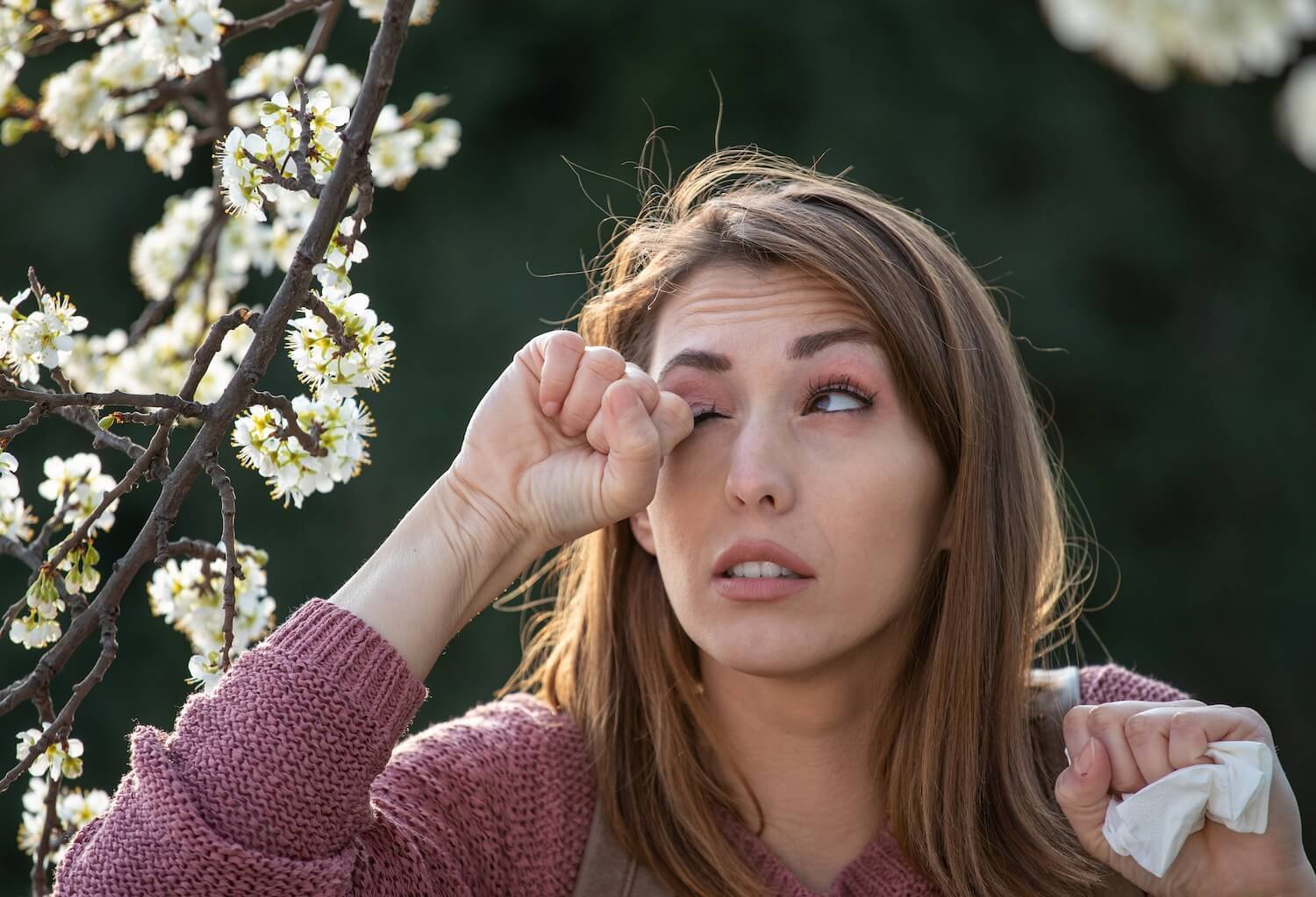 Eye Allergies Causes, Symptoms, Treatment & Prevention