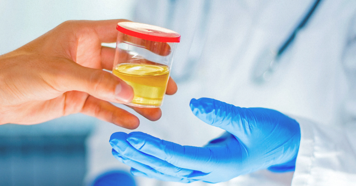 The Urine Series: Your guide to Human Urine | All Things Kidney ~ Official