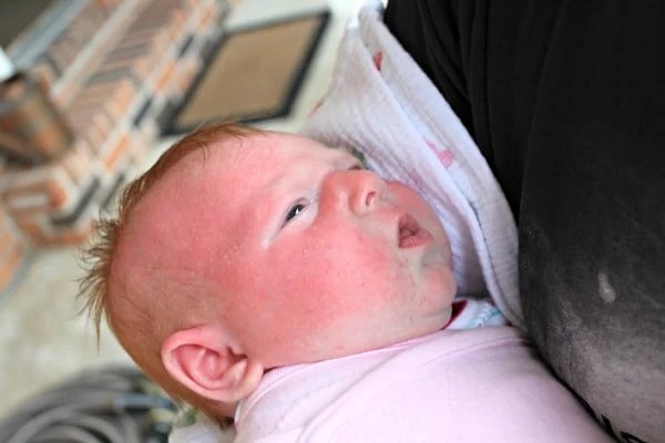 Caution To All Parents My Baby Sunburned In The Shade All Things Mamma