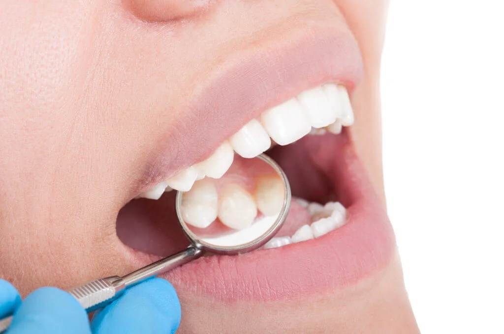 Celebrities Teeth Whitening Secrets That Are Eeasy To Follow