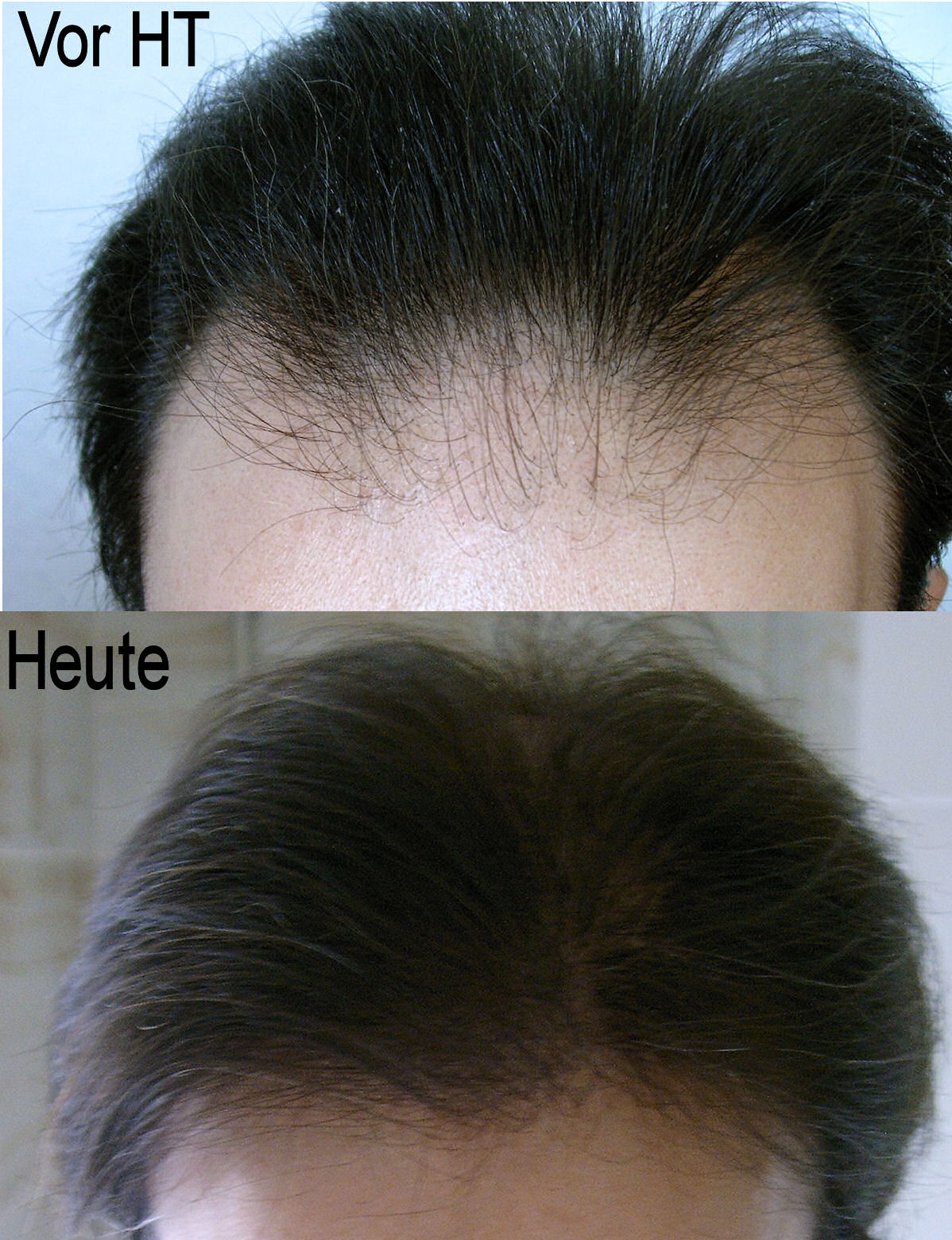 Um trockenem haar feuchtigkeit zu. Haarausfall - Allgemeines Forum : Haare und Haarausfall ...
