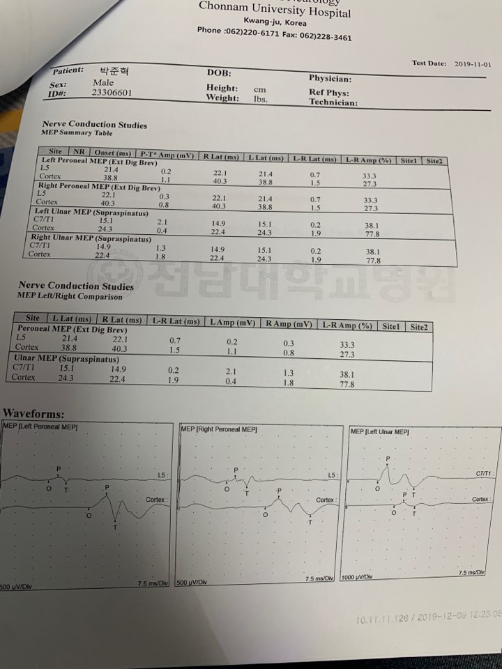 Questions regarding my EMG results ALS Support Community