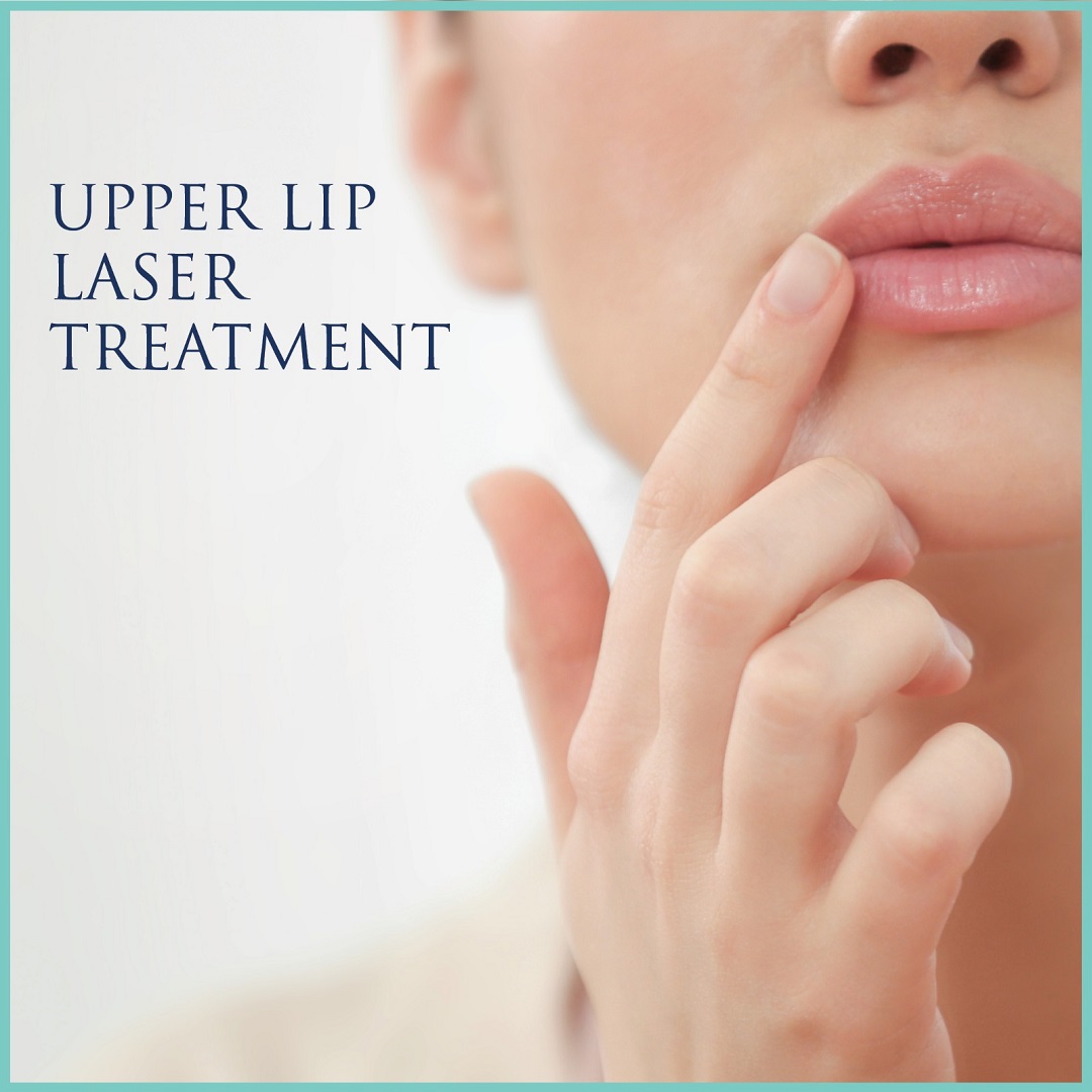 Upper lip laser treatment Amai