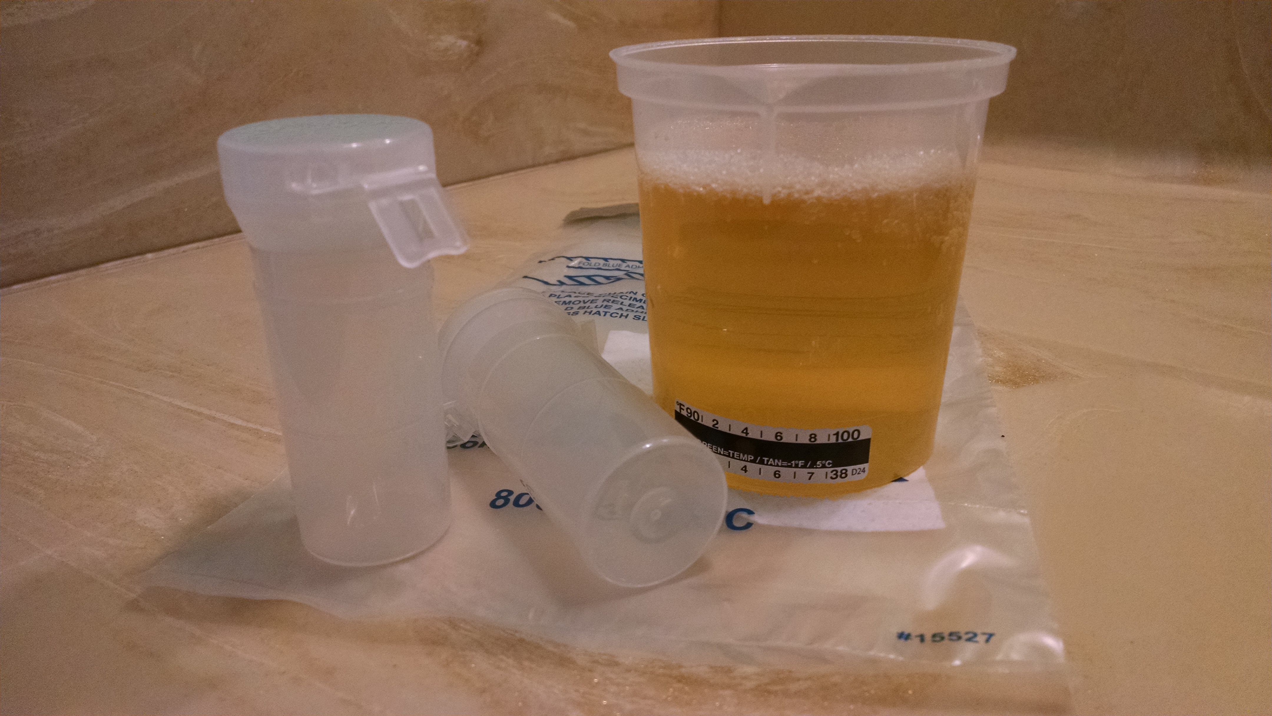 NEGATIVE DILUTE FACT SHEET AMC Drug Testing