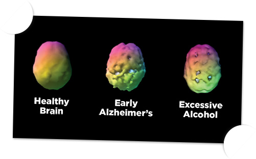 Brain Health /ADHD Eating Disorder Therapy in Charlotte, NC ADD