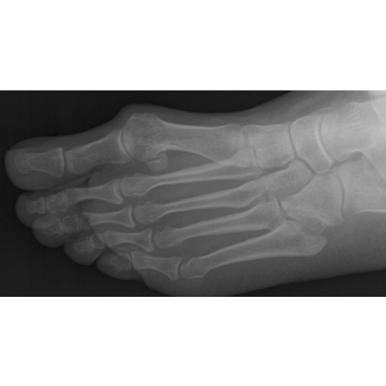 This Bone Doesn't Usually Work Alone