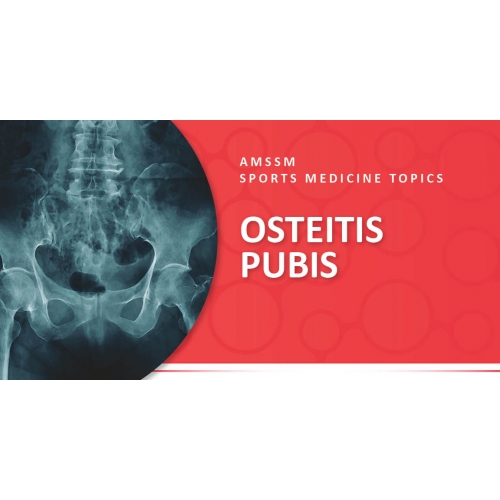 OSTEITIS PUBIS Sports Medicine Today