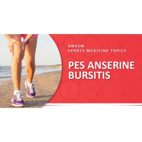 PES ANSERINE BURSITIS Sports Medicine Today