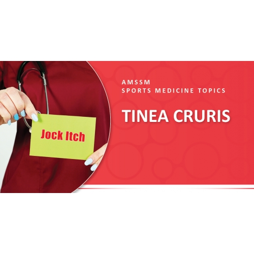 TINEA CRURIS Sports Medicine Today