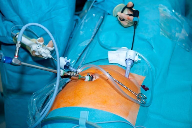 Laparoscopy Dr Amy Tang Gynaecological Oncologist Gynaecologist Brisbane