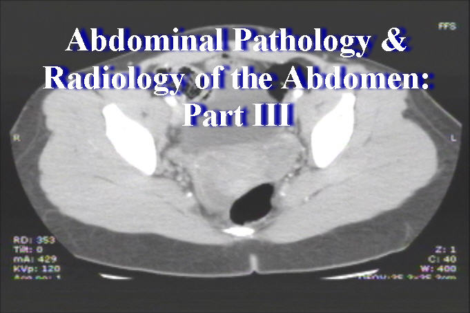 Abdominal Pathology & Radiology of the Abdomen Part 3