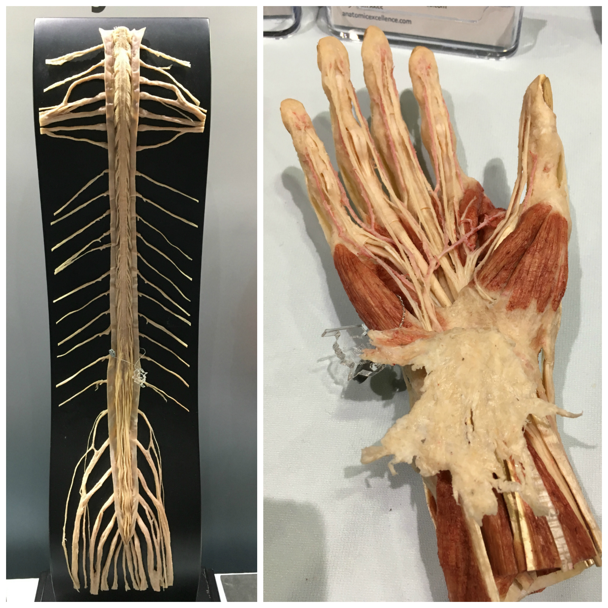 AT at American Association of Anatomists Conference