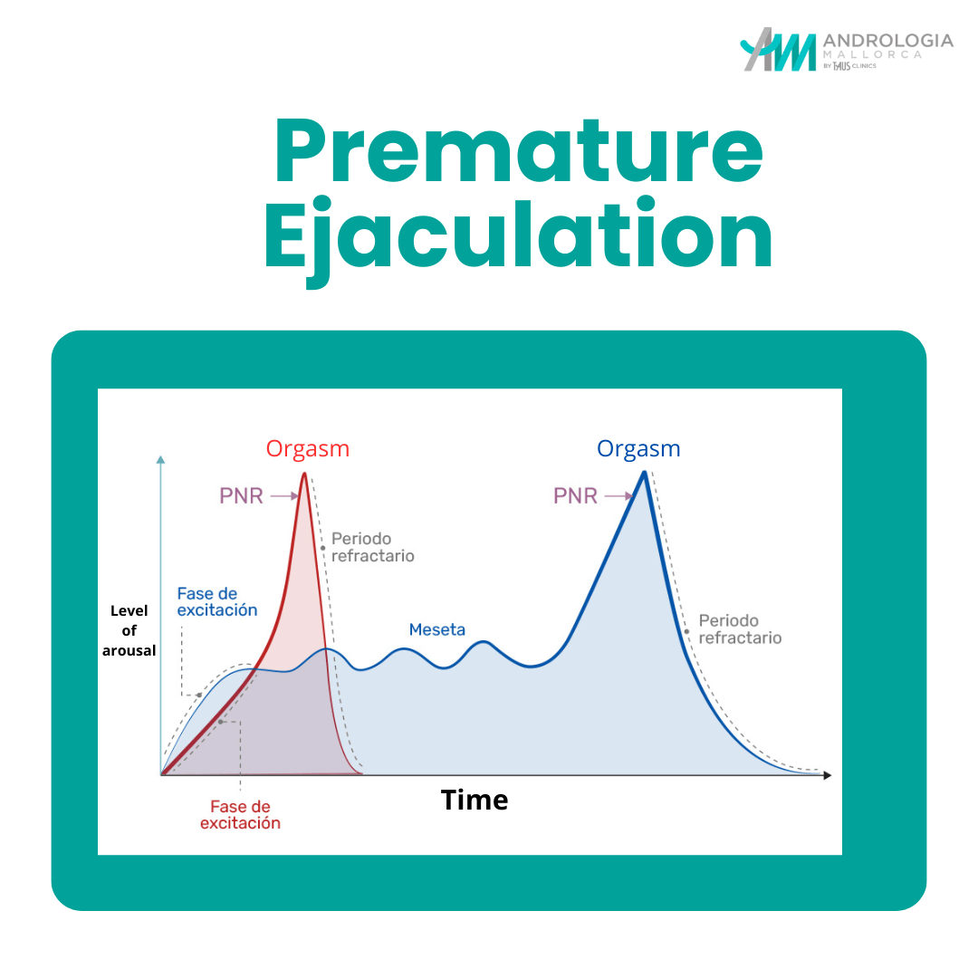 Premature Ejaculation | Andrología Barcelona