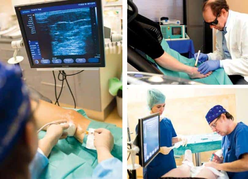 Venen heilen statt operieren