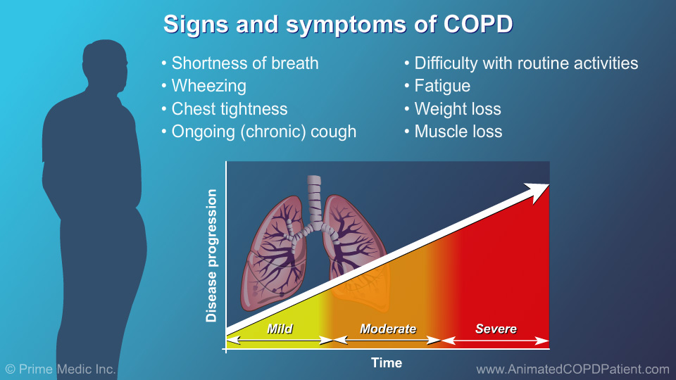 Slide Show Understanding COPD