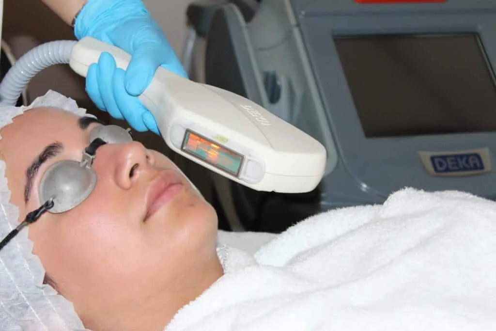 Skin Rejuvenation Another Level Medispa