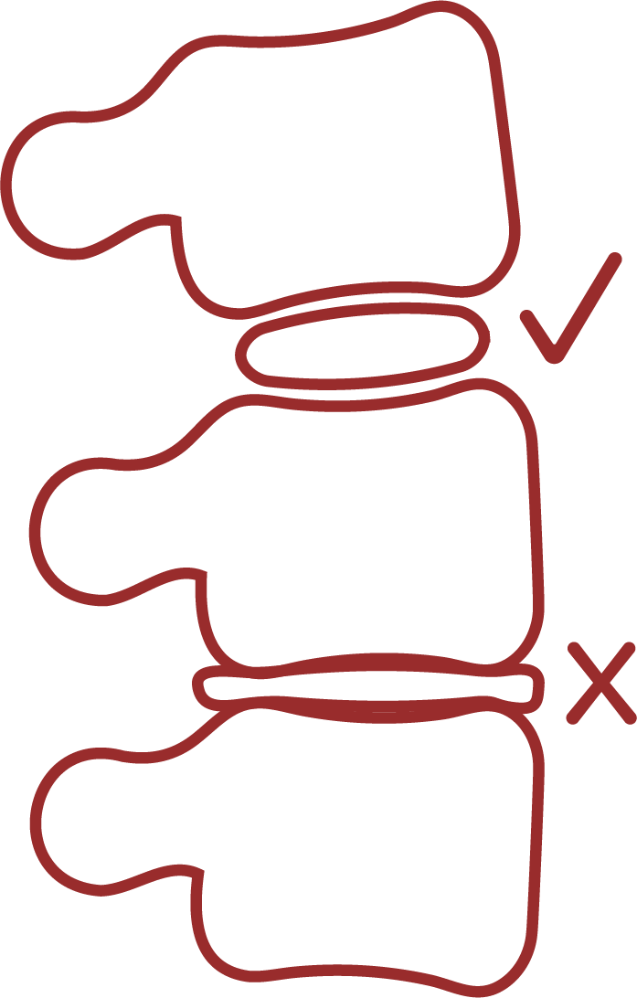 The Office Chair for Herniated Disc